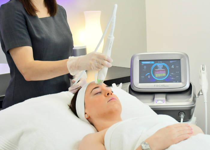 Radiofrequency microneedle treatment